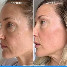 ANTIAGING TREATMENT