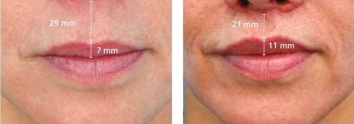 CONTORNO DE LABIOS WALKIN