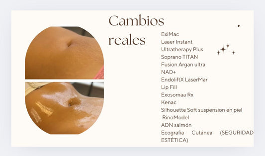 LOSS WEIGHT MEMBRESIA