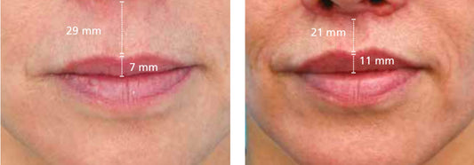 CONTORNO DE LABIOS WALKIN